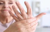 Arthritis Naturally