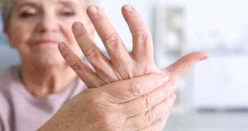 Arthritis Naturally